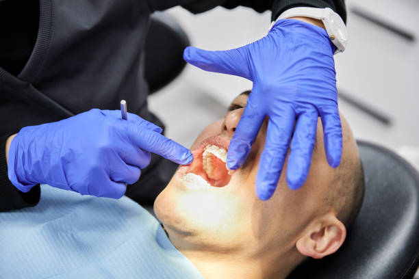 Best Emergency Wisdom Teeth Removal in Pierson, FL