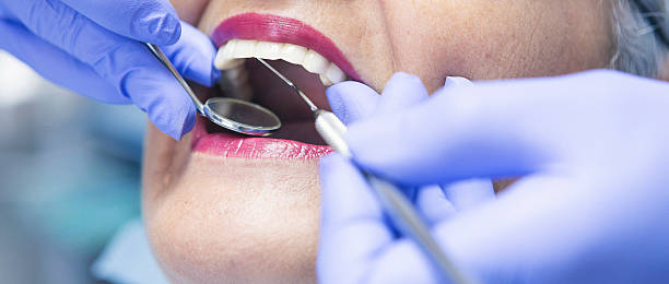 Best Emergency Broken Tooth Repair in Pierson, FL